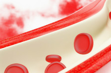 血液粘稠就是高血脂了吗？血液粘稠该怎么办？